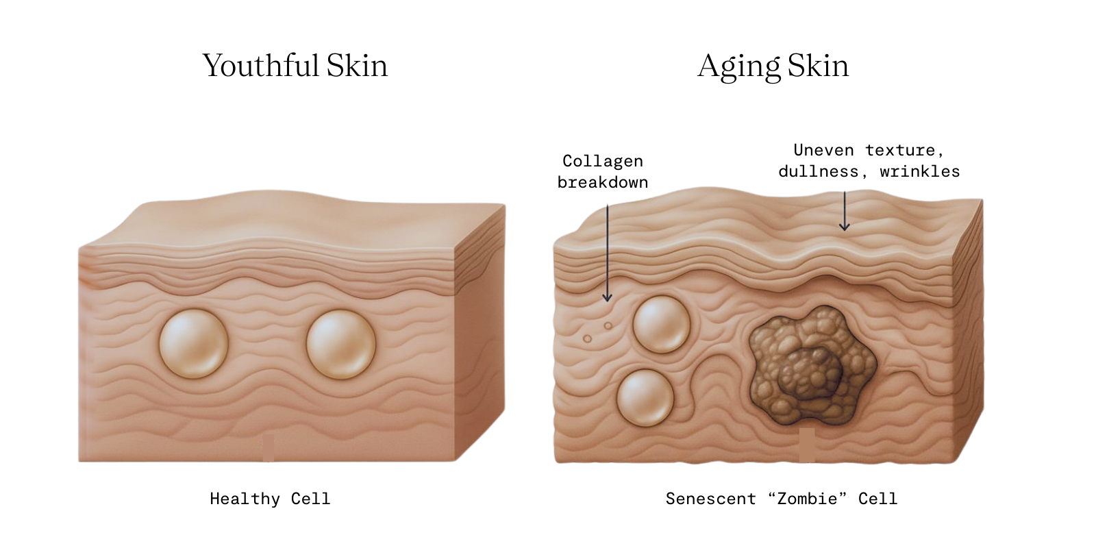 Illustration showing collagen breakdown in skin: healthy youthful skin structure on the left compared to aging skin with damaged collagen and sagging on the right.