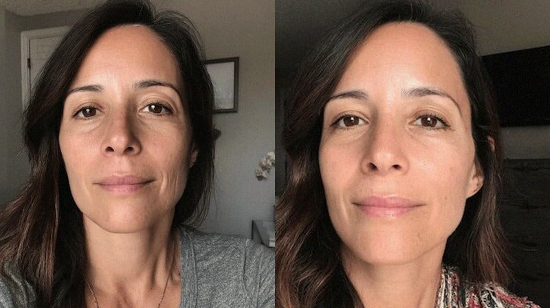 Before and after - study-1